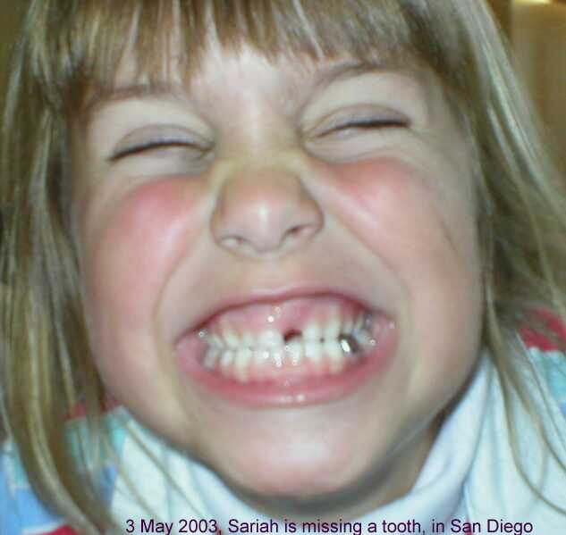 02 May 2003 - Sariah has beautiful TEETH!!